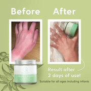 Neem Cream | itreatskin